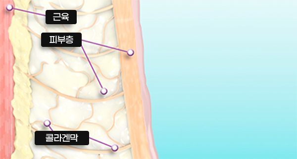 늘어진 콜라겐